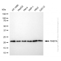 KD-Validated RAB7 Rabbit mAb (20 μl)