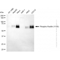 KD-Validated Phospho-PXN (Y118) Rabbit mAb (20 μl)
