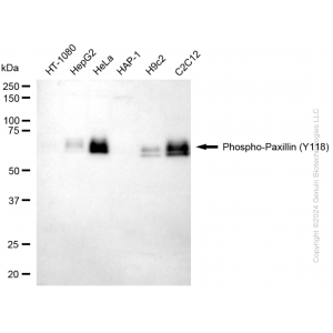 KD-Validated Phospho-PXN (Y118) Rabbit mAb (20 μl)