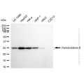 KD-Validated PRDX6 Rabbit mAb (20 μl)