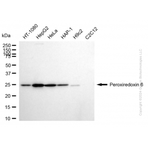 KD-Validated PRDX6 Rabbit mAb (20 μl)