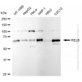 KD-Validated RelB Rabbit mAb (20 μl)