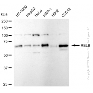 KD-Validated RelB Rabbit mAb (20 μl)
