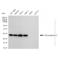 KD-Validated PRDX3 Rabbit mAb (20 μl)