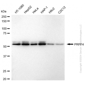KD-Validated PRPF4 Rabbit mAb (20 μl)