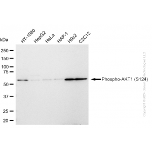 KD-Validated Phospho-AKT1 (S124) Rabbit mAb (20 μl)