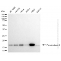 KD-Validated PRDX5 Rabbit mAb (20 μl)