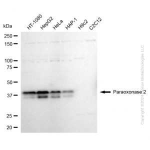 KD-Validated PON2 Rabbit mAb (20 μl)