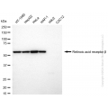 KD-Validated RARB Rabbit mAb (20 μl)