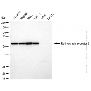 KD-Validated RARB Rabbit mAb (20 μl)