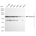 KD-Validated RPN1 Rabbit mAb (20 μl)