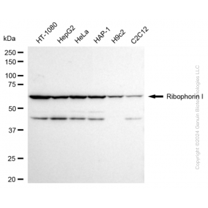 KD-Validated RPN1 Rabbit mAb (20 μl)