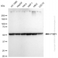KD-Validated PTBP1 Rabbit mAb (20 μl)