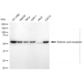 KD-Validated RARA Rabbit mAb (20 μl)
