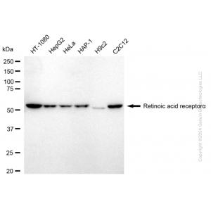 KD-Validated RARA Rabbit mAb (20 μl)