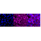 KD-Validated Fibronectin 1 Rabbit mAb (20 μl)