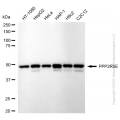 KD-Validated PPP2R5E Rabbit mAb (20 μl)