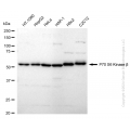 KD-Validated RPS6KB2 Rabbit mAb (20 μl)