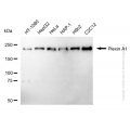 KD-Validated PLXNA1 Rabbit mAb (20 μl)