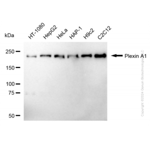 KD-Validated PLXNA1 Rabbit mAb (20 μl)