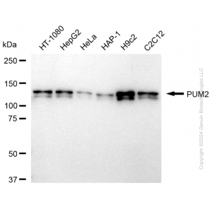 KD-Validated PUM2 Rabbit mAb (20 μl)