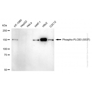 KD-Validated Phospho-PLCB3 (S537) Rabbit mAb (20 μl)