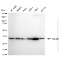 KD-Validated PDLIM1 Rabbit mAb (20 μl)