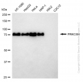 KD-Validated PRKCSH Rabbit mAb (20 μl)