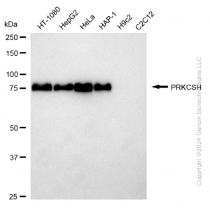 KD-Validated PRKCSH Rabbit mAb (20 μl)