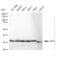 KD-Validated PEF1 Rabbit mAb (20 μl)