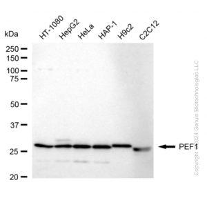 KD-Validated PEF1 Rabbit mAb (20 μl)