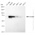 KD-Validated SCARB1 Rabbit mAb (20 μl)