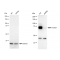 KD-Validated FOXO1 Rabbit mAb (20 μl)