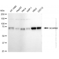 KD-Validated SCARB2 Rabbit mAb (20 μl)
