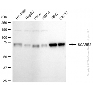 KD-Validated SCARB2 Rabbit mAb (20 μl)