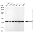 KD-Validated SEPTIN2 Rabbit mAb (20 μl)