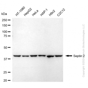 KD-Validated SEPTIN2 Rabbit mAb (20 μl)