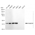 KD-Validated RABEPK Rabbit mAb (20 μl)