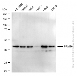 KD-Validated PRMT6 Rabbit mAb (20 μl)