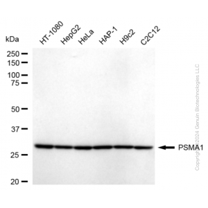 KD-Validated PSMA1 Rabbit mAb (20 μl)