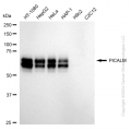 KD-Validated PICALM Rabbit mAb (20 μl)