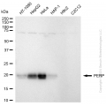 KD-Validated PERP Rabbit mAb (20 μl)