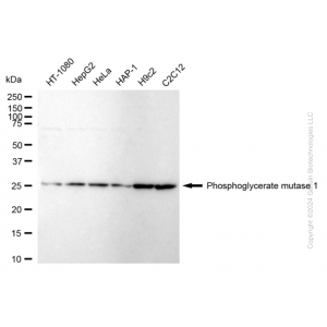 KD-Validated PGAM1 Rabbit mAb (20 μl)