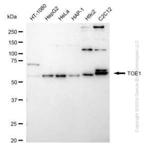 KD-Validated TOE1 Rabbit mAb (20 μl)