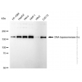 KD-Validated TOP2A Rabbit mAb (20 μl)