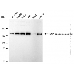KD-Validated TOP2A Rabbit mAb (20 μl)
