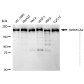 KD-Validated SMARCA4 Rabbit mAb (20 μl)