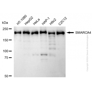 KD-Validated SMARCA4 Rabbit mAb (20 μl)