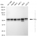 KD-Validated TFG Rabbit mAb (20 μl)