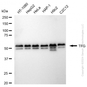 KD-Validated TFG Rabbit mAb (20 μl)
